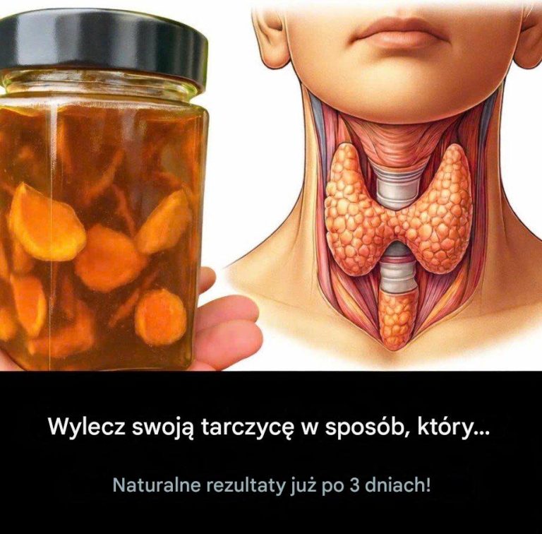 Wylecz_swoj__tarczyc__naturalnie_w_zaledwie_3_dni_