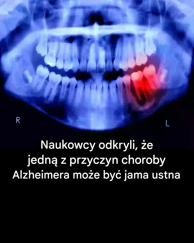 Zaskakuj_ce_odkrycie__nieoczekiwany_zwi_zek_mi_dzy_zdrowiem_jamy_ustnej_a_chorob__Alzheimera