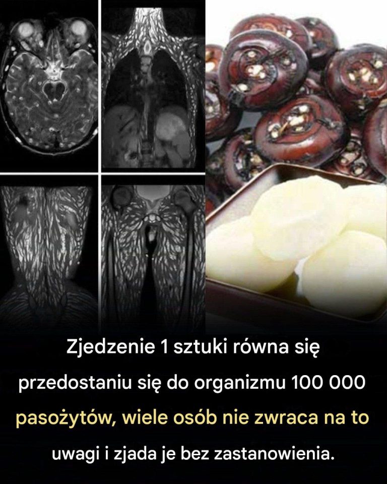 Zjedzenie_jednego_k_sa_mo_e_by__szkodliwe__jak_chroni__si__przed_paso_ytami_przenoszonymi_przez__ywno__