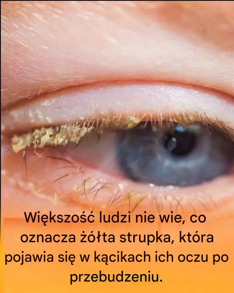 ty_strup_w_k_cikach_oczu_po_przebudzeniu__co_to_oznacza_ ty_strup_w_k_cikach_oczu_po_przebudzeniu__co_to_oznacza_