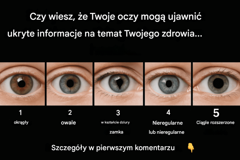 Co_kszta_t_Twojej__renicy_mo_e_ujawni__na_temat_Twojego_stanu_zdrowia