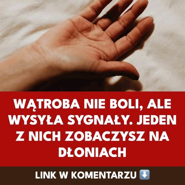 Czerwone_d_onie___czy_to_sygna__problem_w_z_w_trob___Sprawd___co_oznacza_rumie__d_oniowy