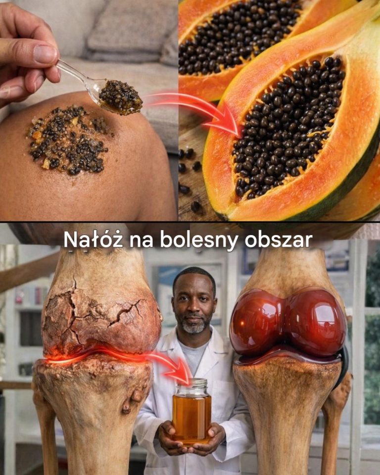 Jak_nasiona_papaji_mog__wspiera__komfort_staw_w__prosty_domowy_spos_b_na_dyskomfort_kolan__plec_w_i_kr_gos_upa-1