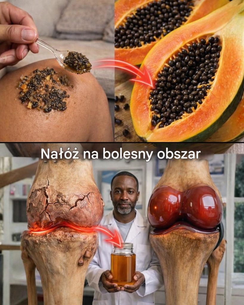 Jak_nasiona_papaji_mog__wspiera__komfort_staw_w__prosty_domowy_spos_b_na_dyskomfort_kolan__plec_w_i_kr_gos_upa-1 Jak_nasiona_papaji_mog__wspiera__komfort_staw_w__prosty_domowy_spos_b_na_dyskomfort_kolan__plec_w_i_kr_gos_upa-1