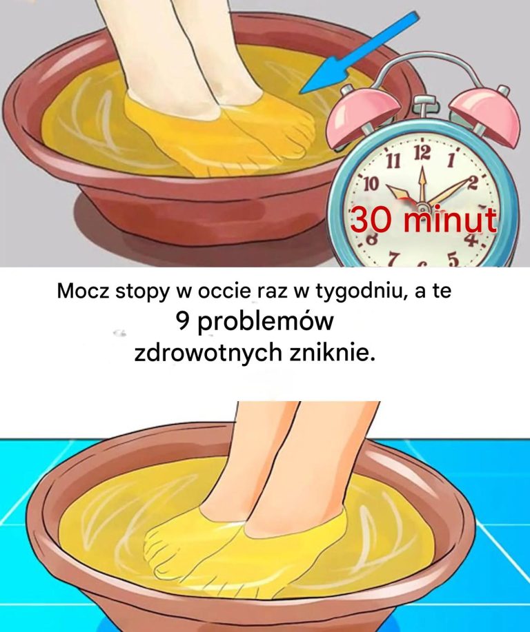 K_piel_st_p_w_occie_raz_w_tygodniu_pozwoli_Ci_pozby__si__9_powszechnych_problem_w_zdrowotnych_