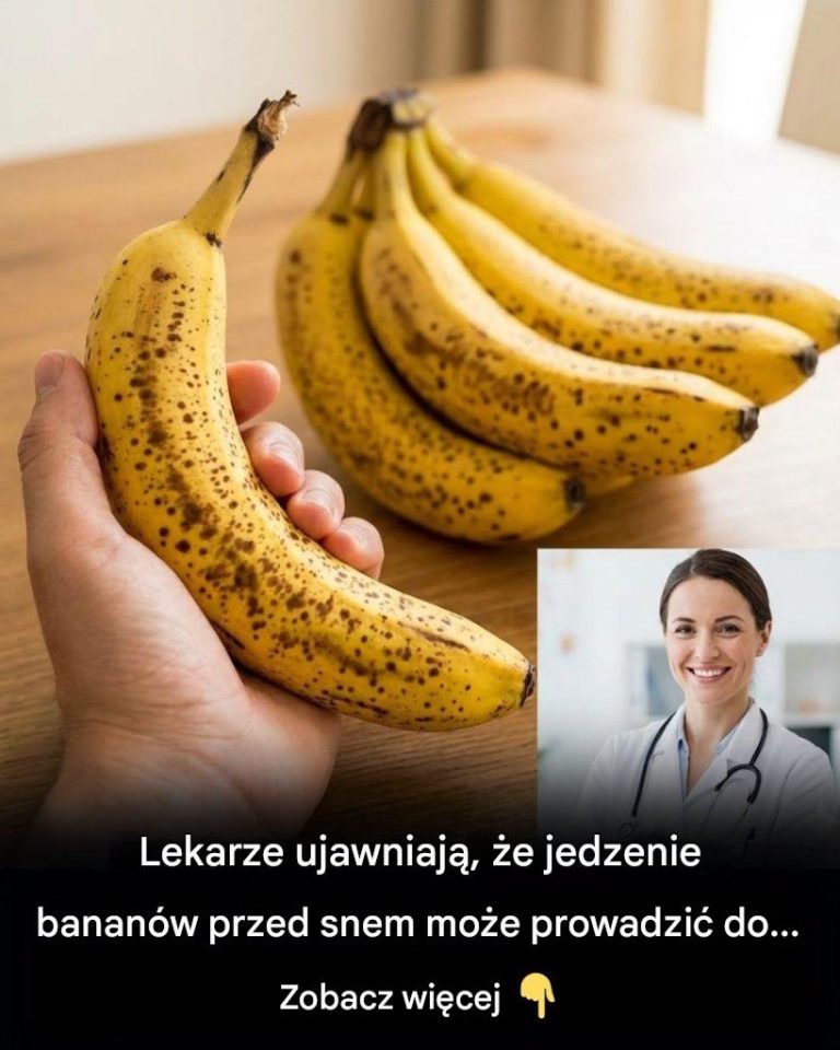 Lekarze_ujawniaj____e_jedzenie_banan_w_przed_snem_mo_e_prowadzi__do__Zobacz_wi_cej___