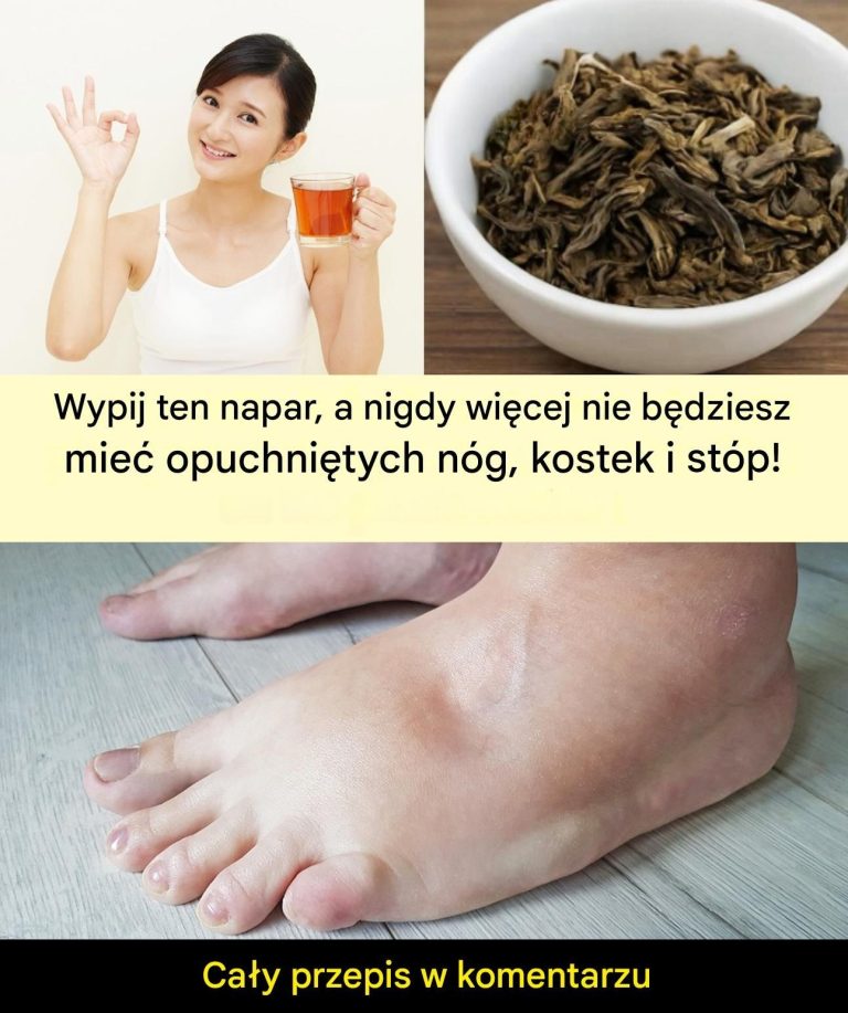 Przepis__Napar_na_opuchni_te_nogi