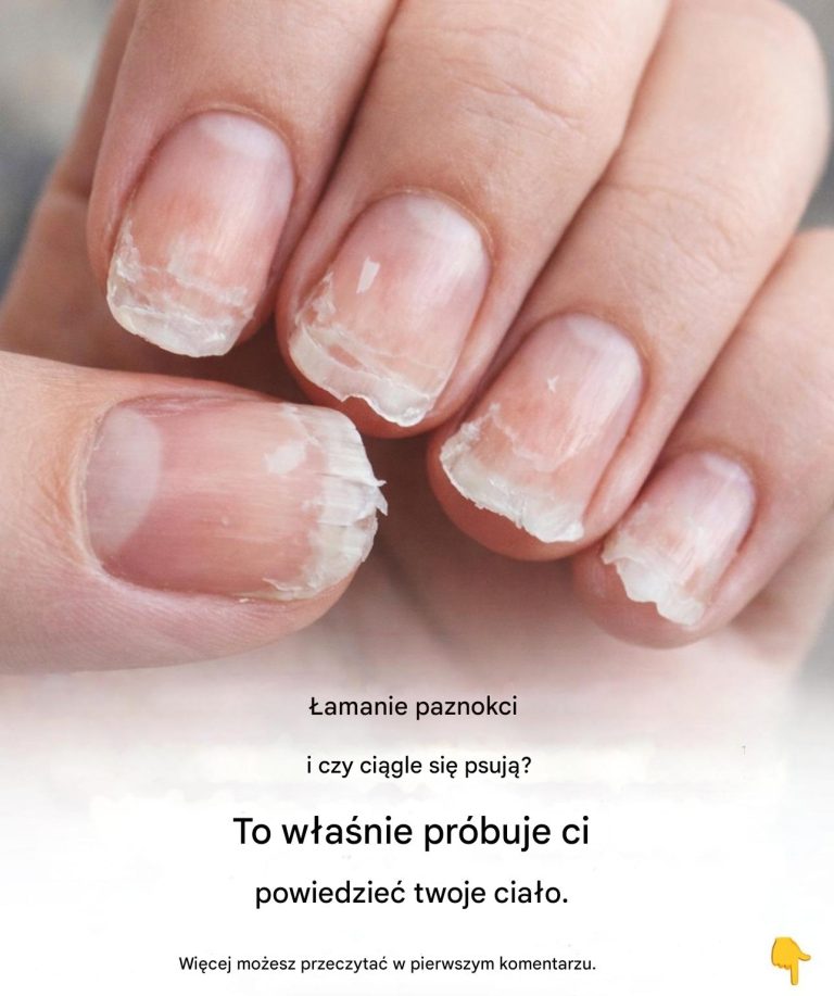 amliwe_i_rozdwajaj_ce_si__paznokcie__co_pr_buje_Ci_powiedzie__Twoje_cia_o