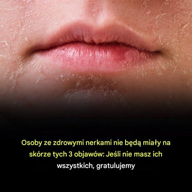 3_oznaki_choroby_nerek_po_sk_rze___brak_objaw_w__Jeste__czysty_-1