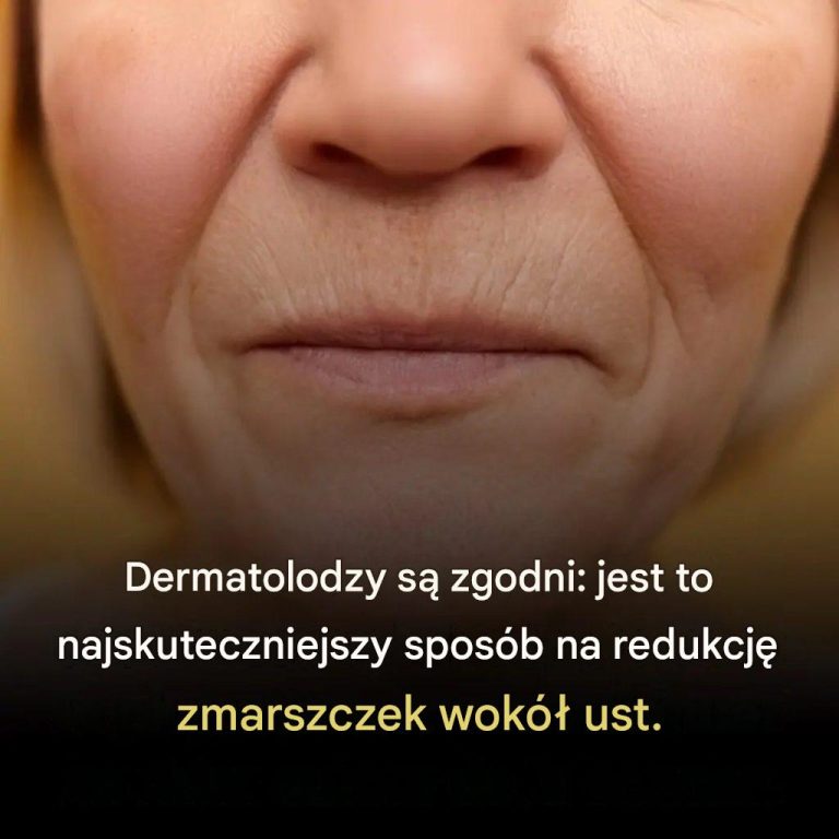 Dermatolodzy_s__zgodni__to_najskuteczniejszy_produkt_redukuj_cy_zmarszczki_wok___ust