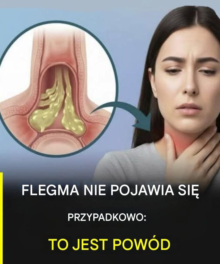 Jak_zmniejszy__nadmiar_flegmy