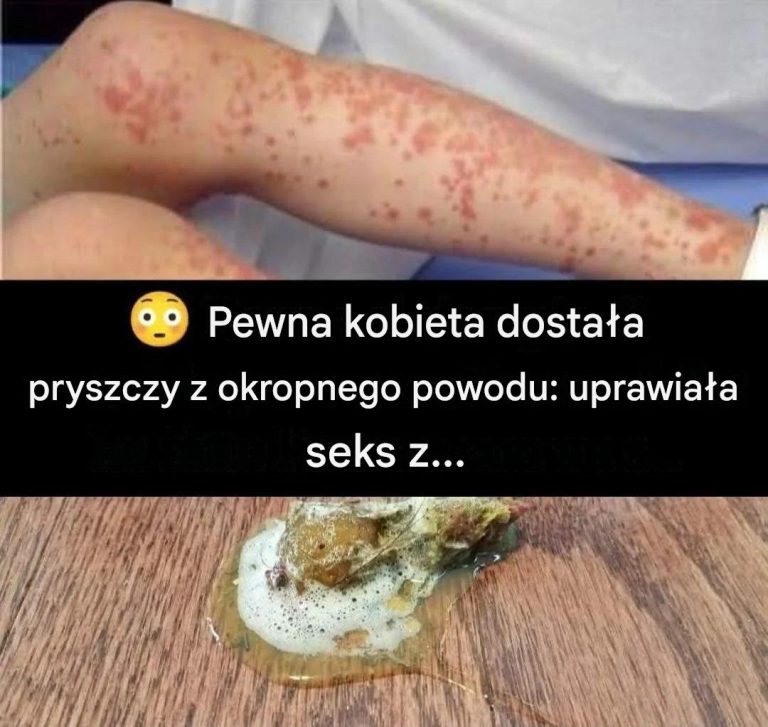 Kobieta_ma_pryszcze__Okropny_pow_d___Zrobi_a___1___2_