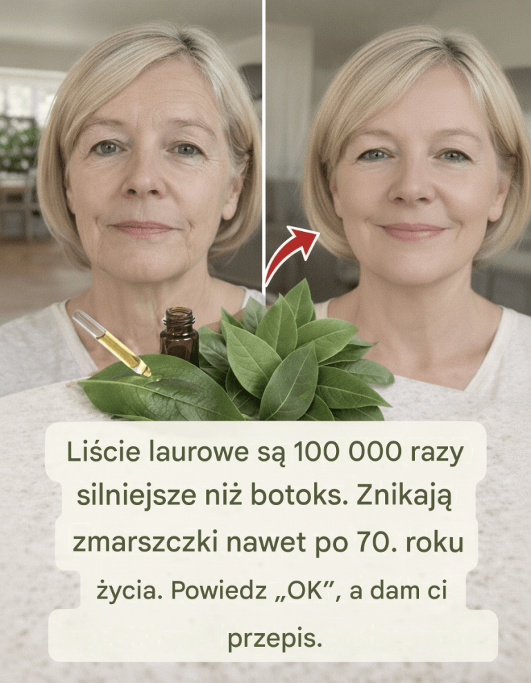 Li___laurowy_na_zmarszczki__naturalny__rodek_przeciwstarzeniowy__kt_ry_od_ywia_sk_r_
