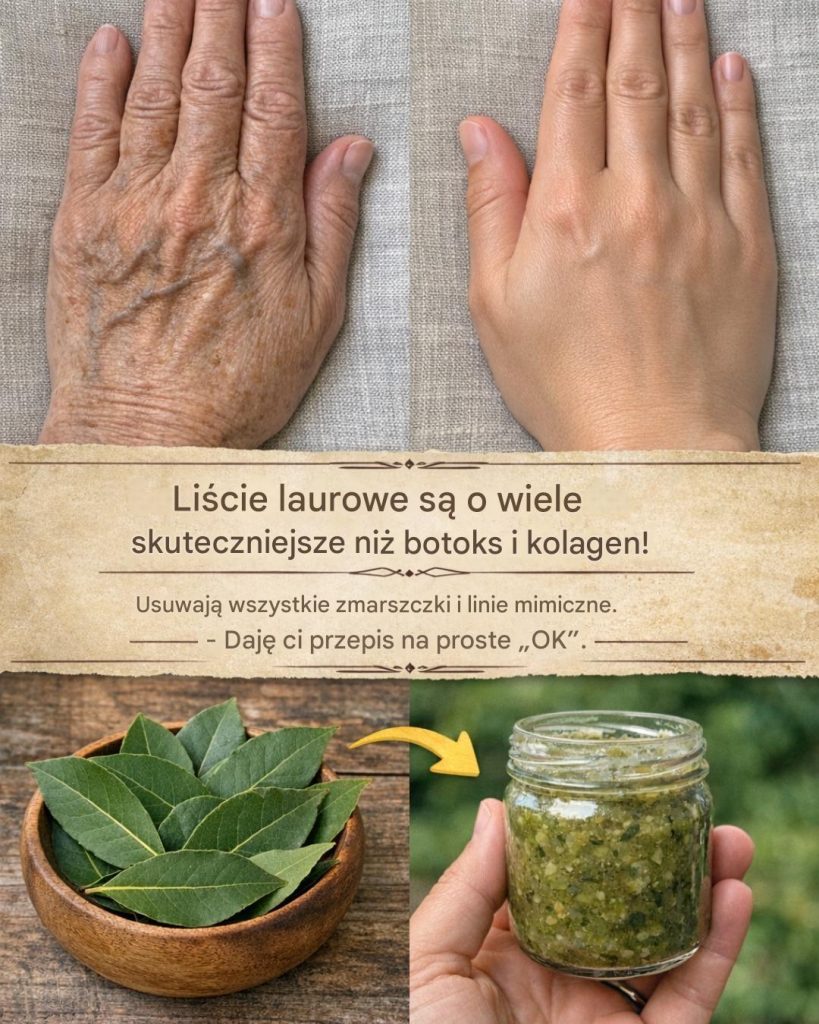 Li_cie_laurowe_s__o_wiele_skuteczniejsze_ni__botoks_i_kolagen__Niweluj__wszystkie_zmarszczki_i_linie_mimiczne__Musisz_co__powiedzie____ebym_mog_a_dalej_otrzymywa__moje_przepisy_ Li_cie_laurowe_s__o_wiele_skuteczniejsze_ni__botoks_i_kolagen__Niweluj__wszystkie_zmarszczki_i_linie_mimiczne__Musisz_co__powiedzie____ebym_mog_a_dalej_otrzymywa__moje_przepisy_