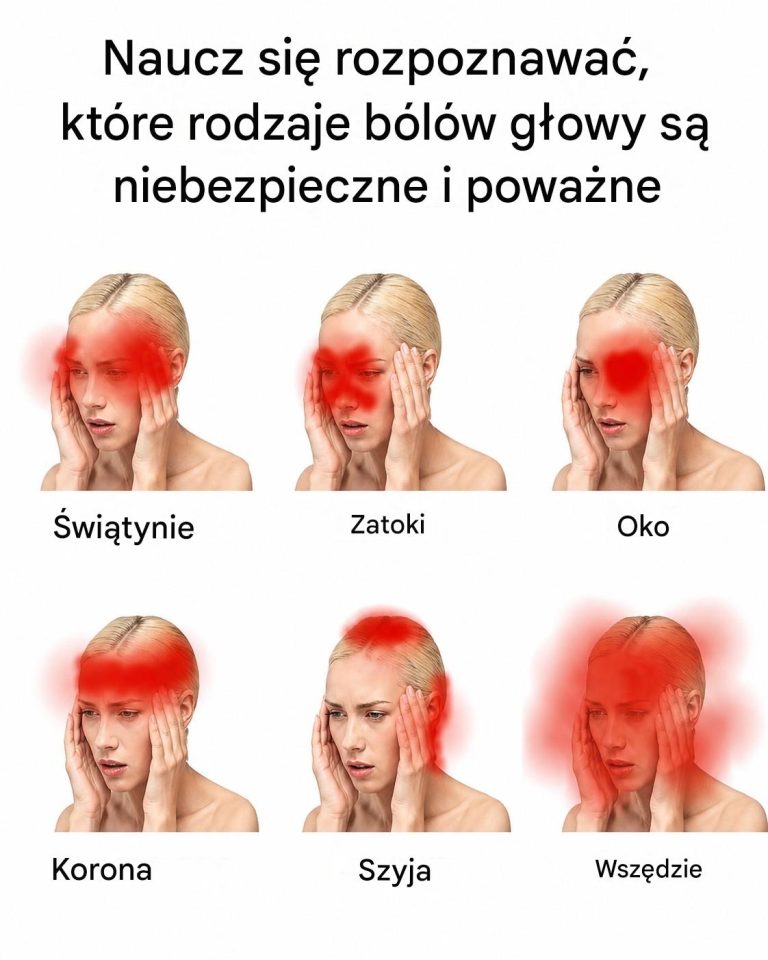 Naucz_si__rozpoznawa___kt_re_rodzaje_b_l_w_g_owy_s__niebezpieczne_i_powa_ne