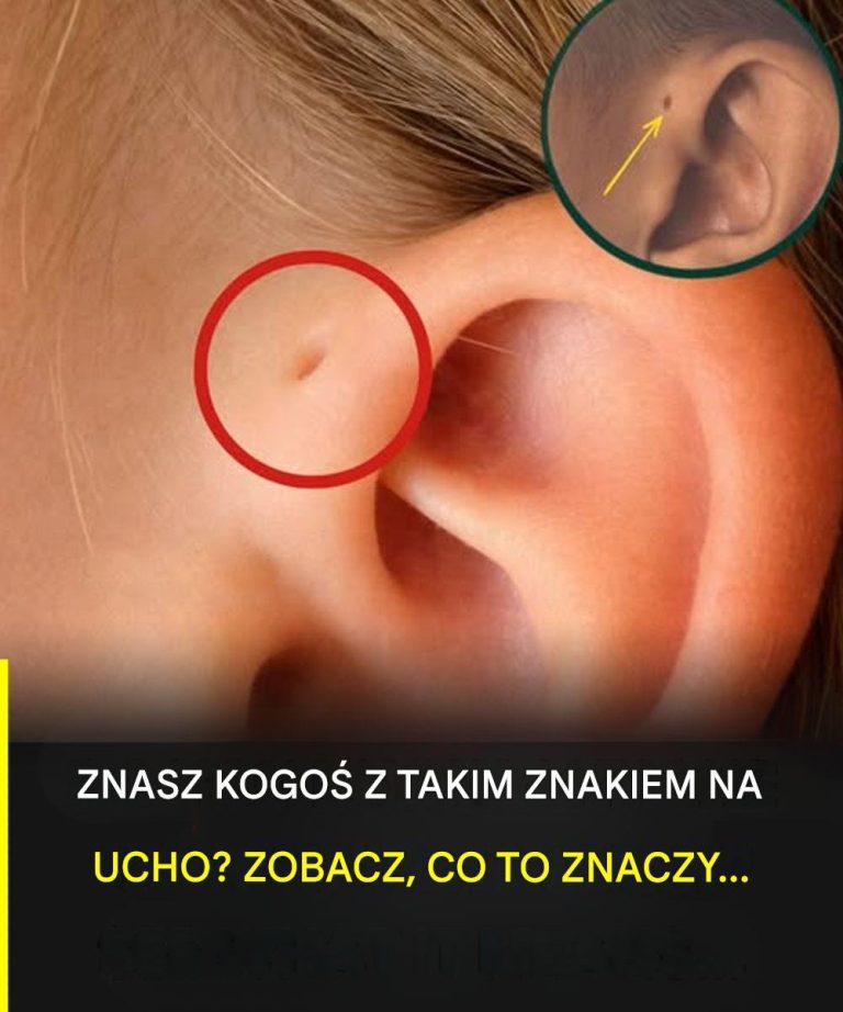 Odkryj_znaczenie_tego_szczeg_lnego_znaku_na_uchu_