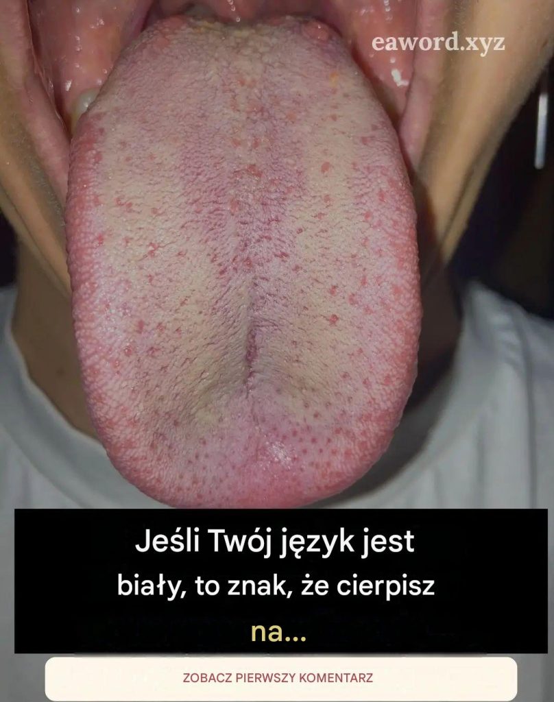 Osoba_z_bia_ym_j_zykiem_niew_tpliwie_ma__Zobacz_wi_cej