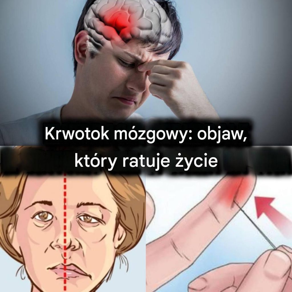 Oto_jak_mo_esz_uratowa__pacjenta_po_udarze__u_ywaj_c_tylko_ig_y__1___3_-1