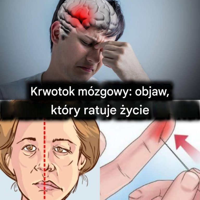 Oto_jak_mo_esz_uratowa__pacjenta_po_udarze__u_ywaj_c_tylko_ig_y__1___3_-1