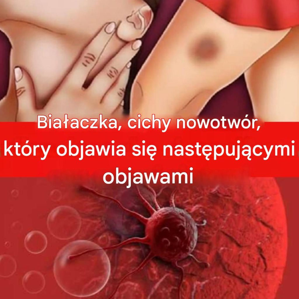 Oto_kilka_typowych_objaw_w__kt_re_mog__wskazywa__na_raka__1___2_