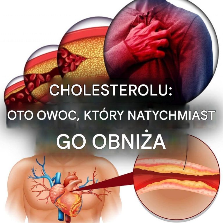 Owoc_o_niesamowitych_w_a_ciwo_ciach__reguluje_ci_nienie_krwi__obni_a_poziom_cholesterolu_i_wiele_wi_cej___1___3_