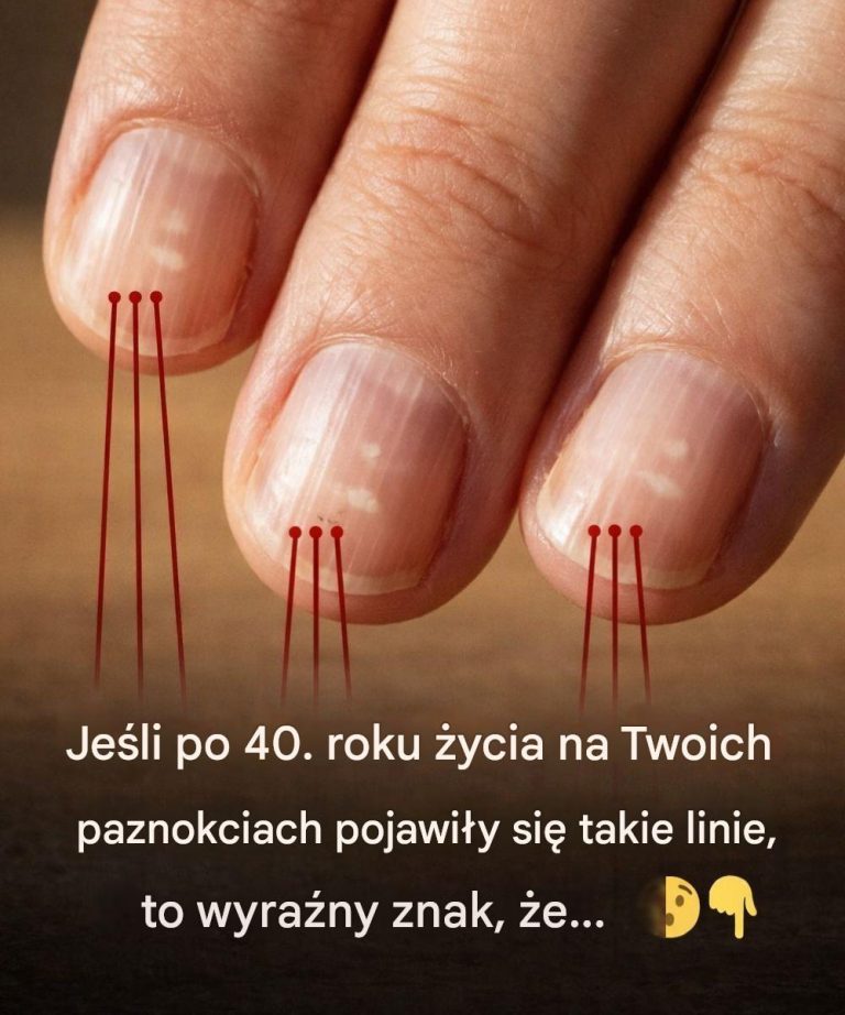 Produkty_spo_ywcze__kt_re_sprawiaj____e_paznokcie_wygl_daj__jak_czterdzie_ci_po_czterdziestce