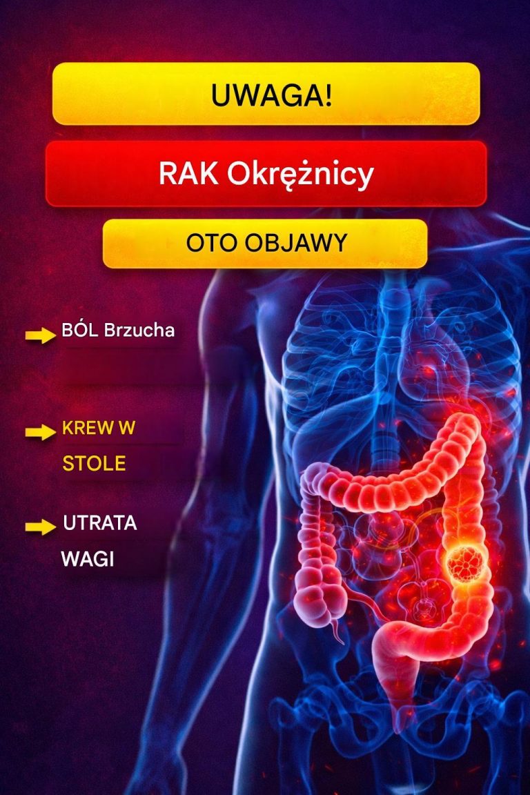 Rak_jelita_grubego___patologia__kt_ra_dotkn__a_Jamesa_Van_Der_Beeka__objawy__na_kt_re_nale_y_zwr_ci__uwag___1_2_