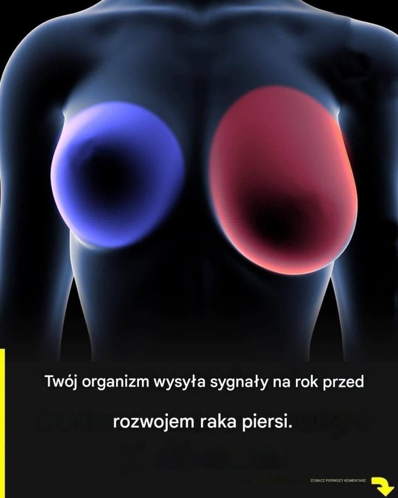 Rak_piersi__4_wczesne_objawy__kt_re_powinna_zna__ka_da_kobieta_