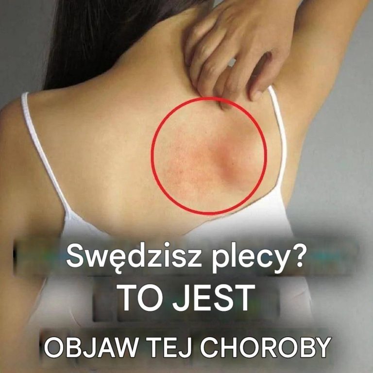 Sw_dzenie_sk_ry_na_ca_ym_ciele__przyczyny_i_naturalne_sposoby_leczenia__1___4_-2