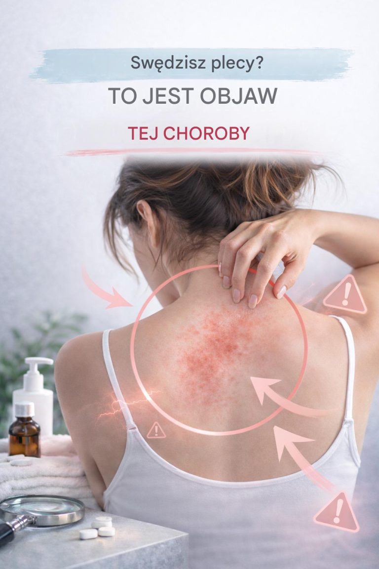 Sw_dzenie_sk_ry_na_ca_ym_ciele__przyczyny_i_naturalne_sposoby_leczenia__1___4_-3