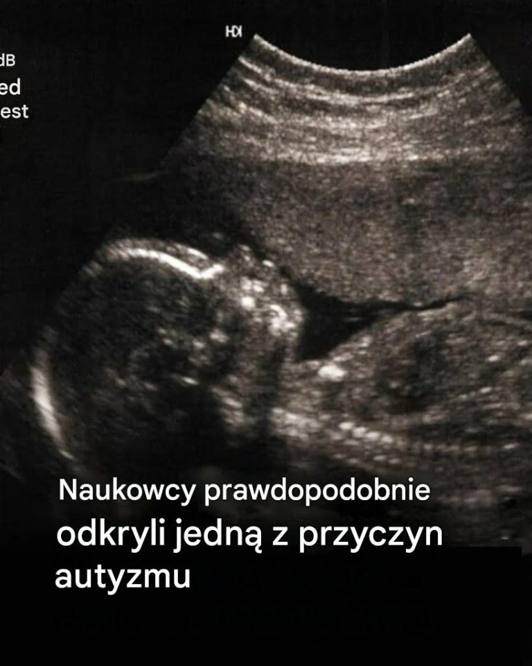 Wykrywanie_autyzmu_w_najwcze_niejszych_momentach__obiecuj_ca_droga_do_wykrycia_autyzmu_we_krwi_noworodk_w